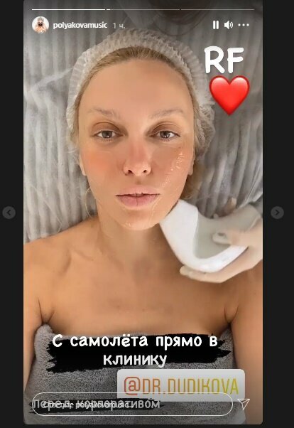 Оля Полякова. Фото: скриншот Instagram-сторис