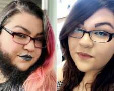 "По-настоящему красивая": девушка отреклась от "станков" после ежедневного бритья в течение 16 лет