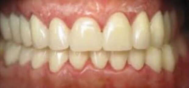 Зубы: скрин с видео