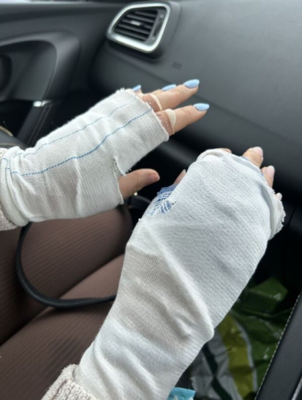 Люси вынуждена носить перчатки из-за травм